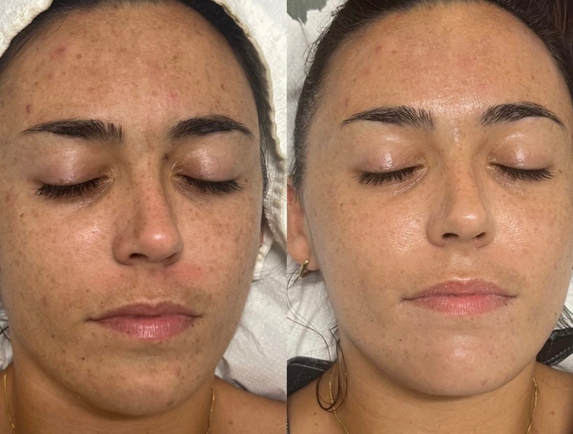 Pack Detox: Mousse Limpiadora Détox y Tónico Equilibrante