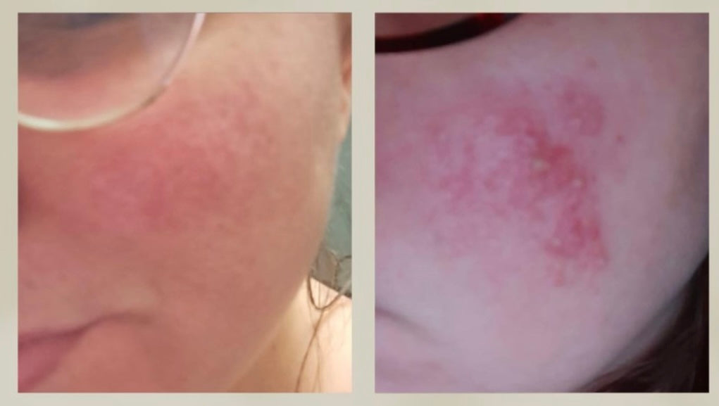 Pack Detox: Mousse Limpiadora Détox y Tónico Equilibrante