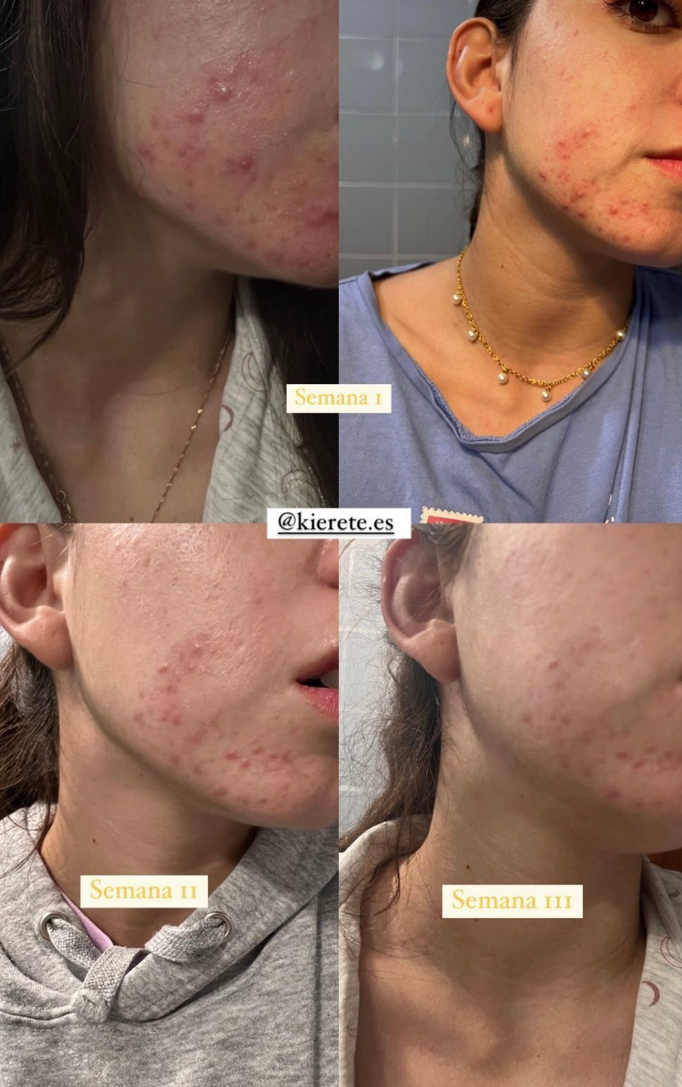 Pack Detox: Mousse Limpiadora Détox y Tónico Equilibrante